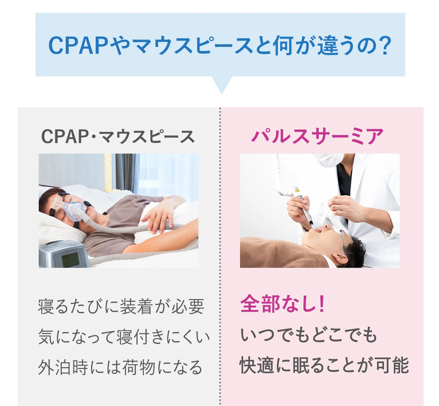 CPAPやマウスピースと何が違うの？