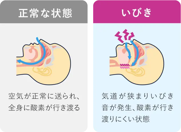 正常な状態といびきの比較図