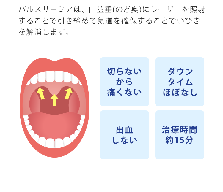 パルスサーミアは、口蓋垂(のど奥)にレーザーを照射することで引き締めて気道を確保します。パルスサ－ミアは、CPAPやマウスピースのような対症治療ではなくいびきの原因を根本から治療します。切らないから痛くない　ダウンタイムほぼなし　出血しない　治療時間約15分